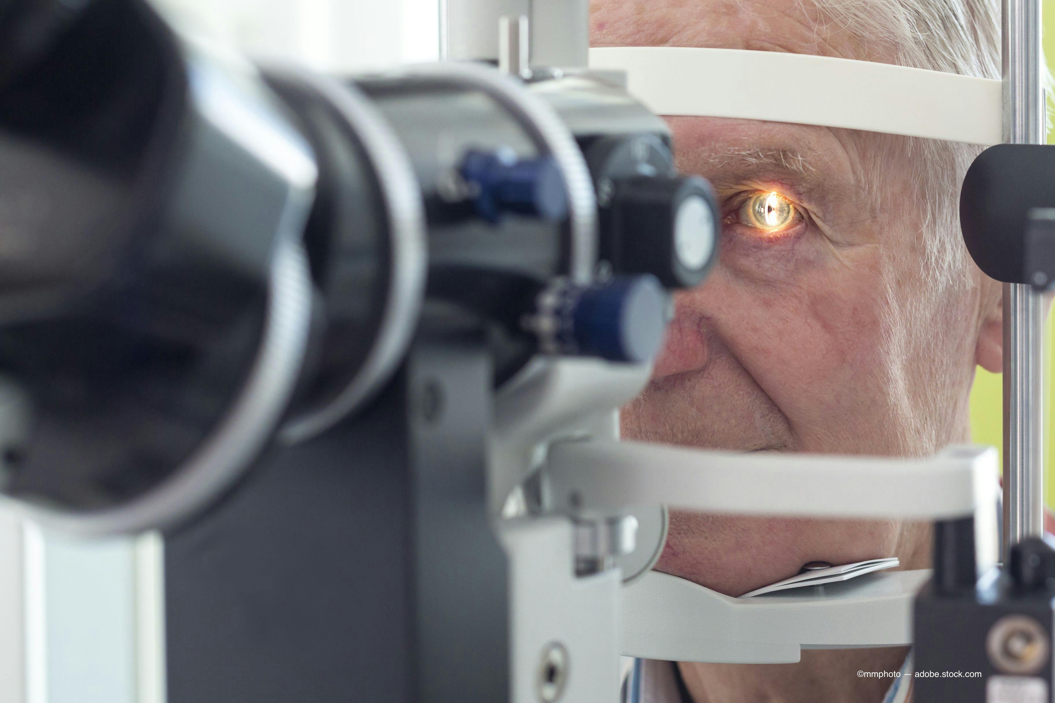 5 easy steps in cataract co-management