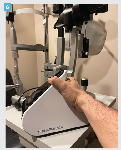 Figure 6. The Biophotonic hand scanner by Pharmanex measures a patient’s skin carotenoid levels in less than 1 minute. This carotenoid biomarker has been correlated with blood serum and macula pigment density. (All photos courtesy of Greg Caldwell, OD, FAAO.)