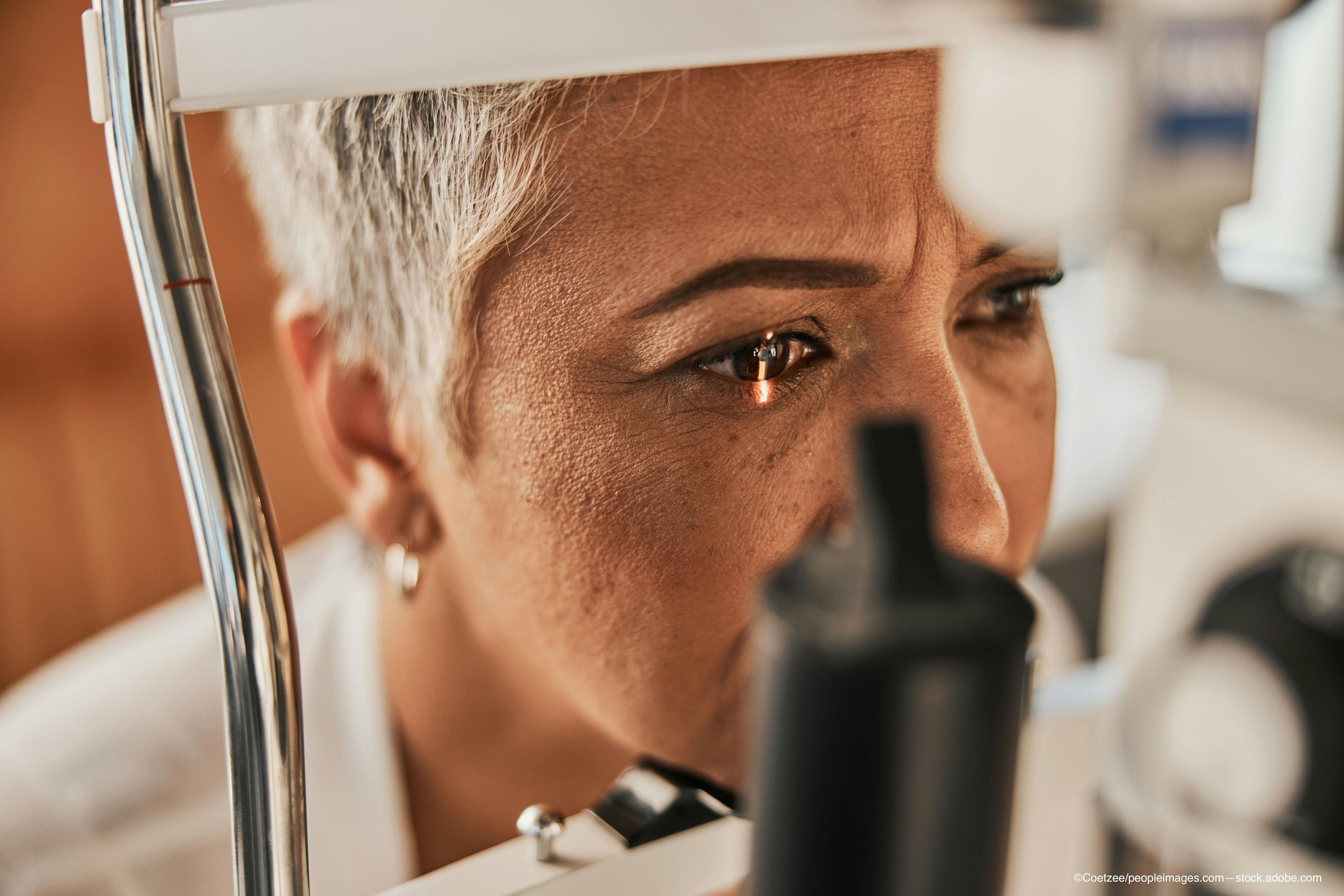 woman getting an eye exam from a retina specialist - Image credit: Adobe Stock / Coetzee/peopleimages.com