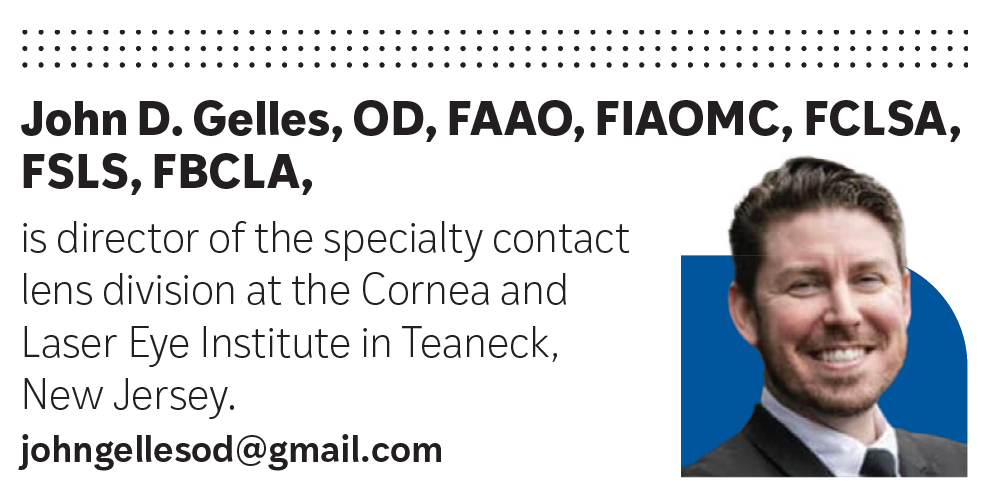 John D. Gelles, OD, FAAO, FIAOMC, FCLSA, FSLS, FBCLA, is director of the specialty contact lens division at the Cornea and Laser Eye Institute in Teaneck, New Jersey. johngellesod@gmail.com