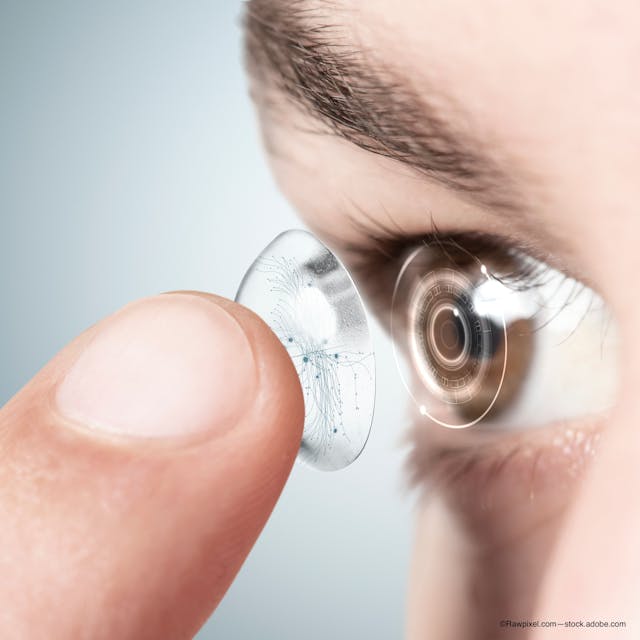 smart contact lenses detect glaucoma track IOP - ©Rawpixel.com